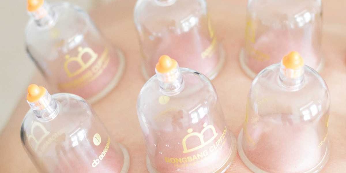 טיפול ב כוסות רוח