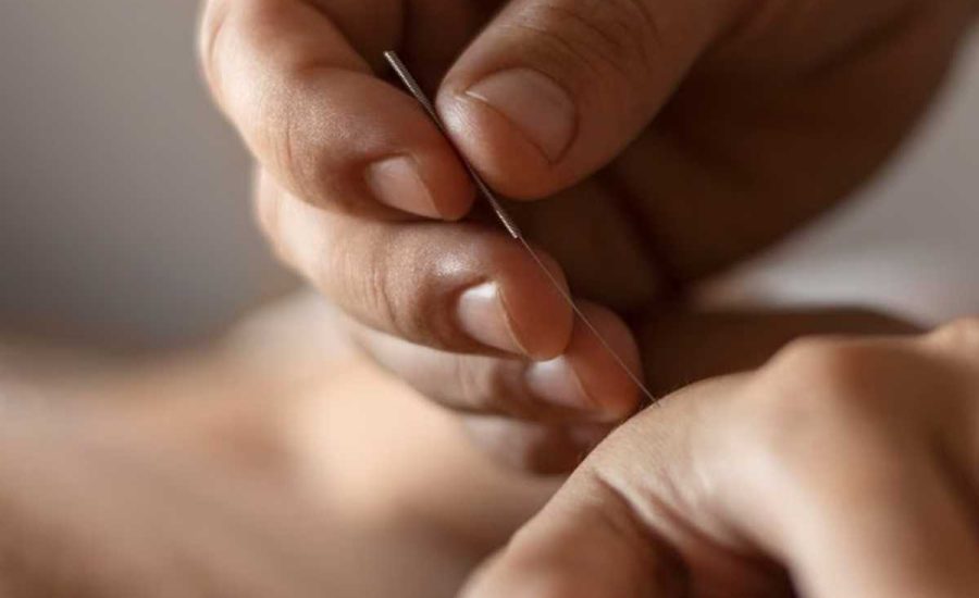 טיפול סו ג'וק - סוג'וק שיטת טיפול קוריאנית במרפאת אור הנר