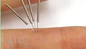 טיפול סוג'וק